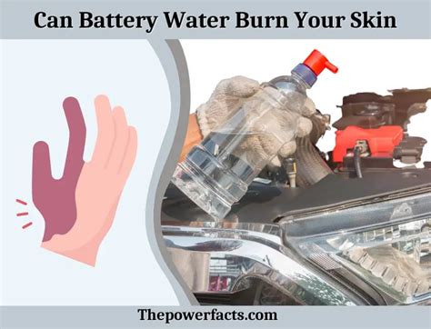 What To Do When Battery Acid Hits Skin: Effective Steps